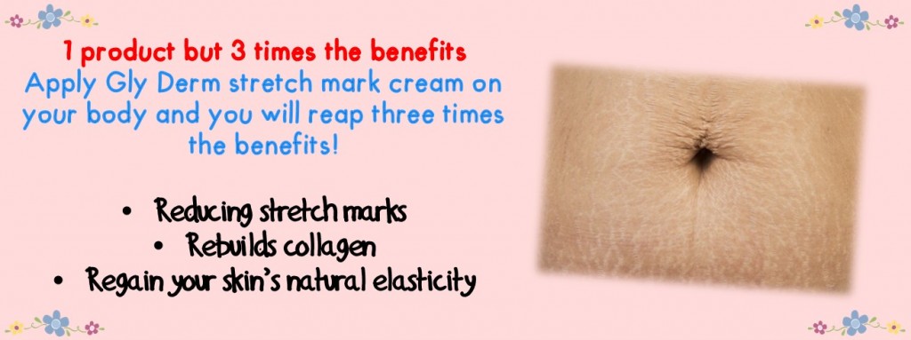 Secret to rid of Stretch Marks