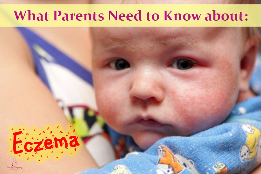 10 Things Parents Should Know About Eczema | Pregnancy in Singapore