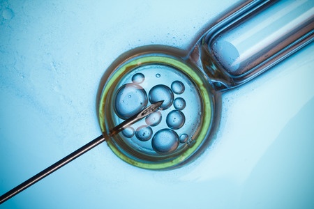 IVF procedure in Singapore