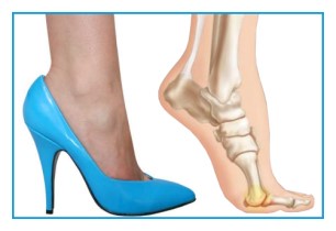 risks associated with wearing high heels