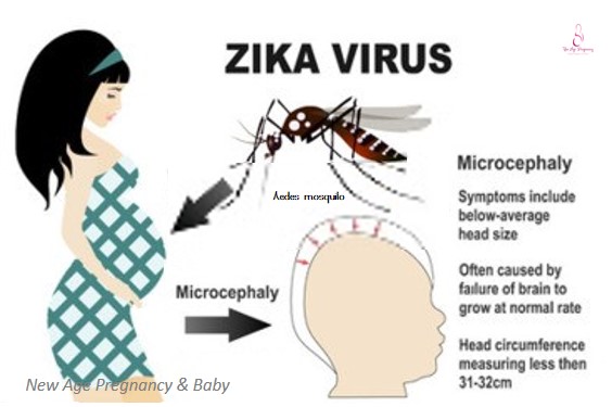 how does zika affect pregnant woman
